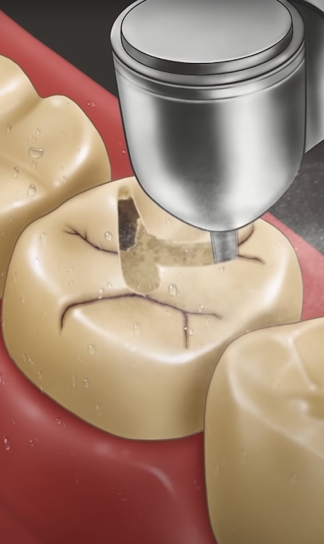 Dentist Master（牙医硕士）