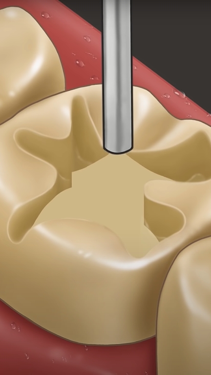 Dentist Master（牙医硕士）