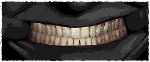 寻找伪人魅魔版 第7张图