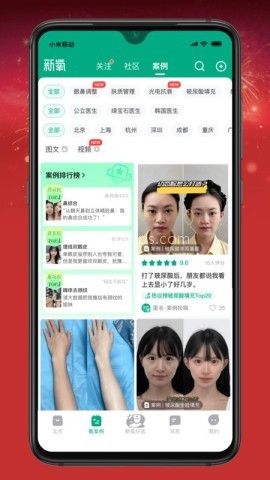 新氧魔镜 第3张图