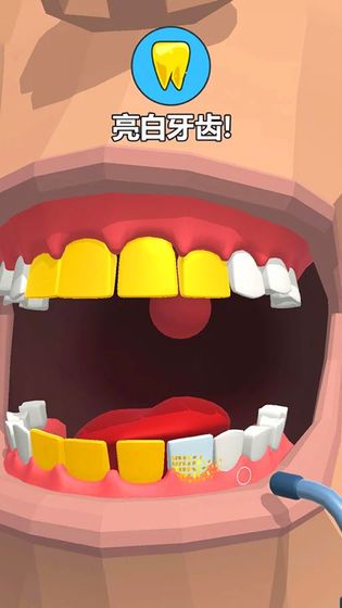 Dentist Bling（拔牙大师）