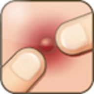 Pimple Popper