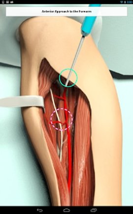 Touch Surgery