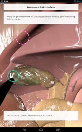 Touch Surgery