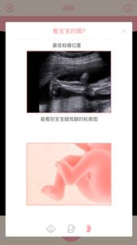 胎儿相机（Fetus Camera）