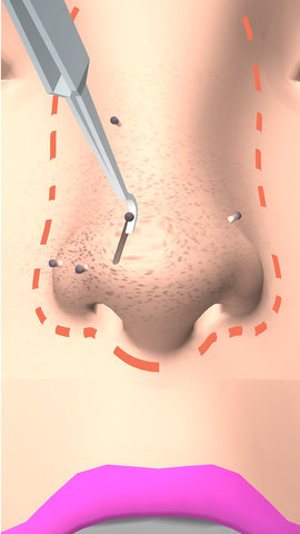 干净的鼻子最新版