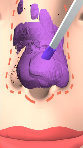 干净的鼻子最新版