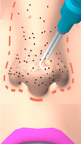 干净的鼻子最新版