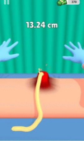 挤疙瘩挑战（Pimple Squeeze）