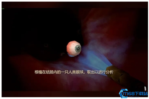 大肠的复仇