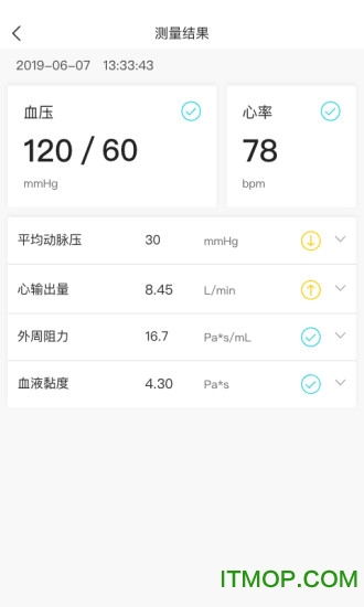 脉迹手环