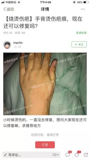疤痕论坛