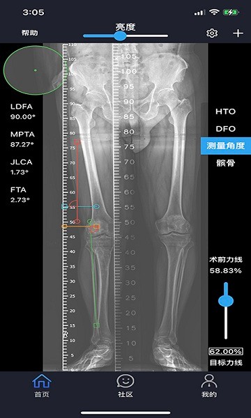 华保膝望