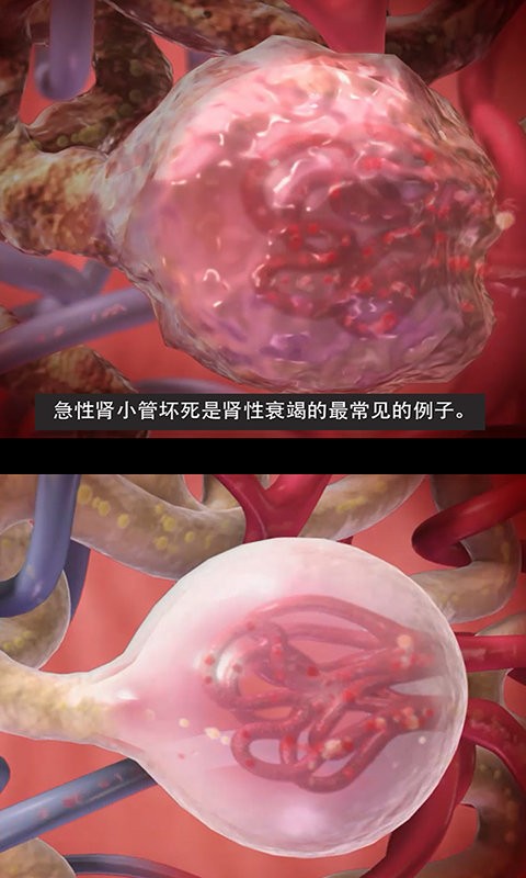 3D生理和病理学医学通