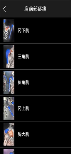 肌肉激痛点图谱