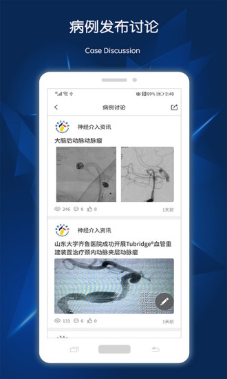 神经介入资讯