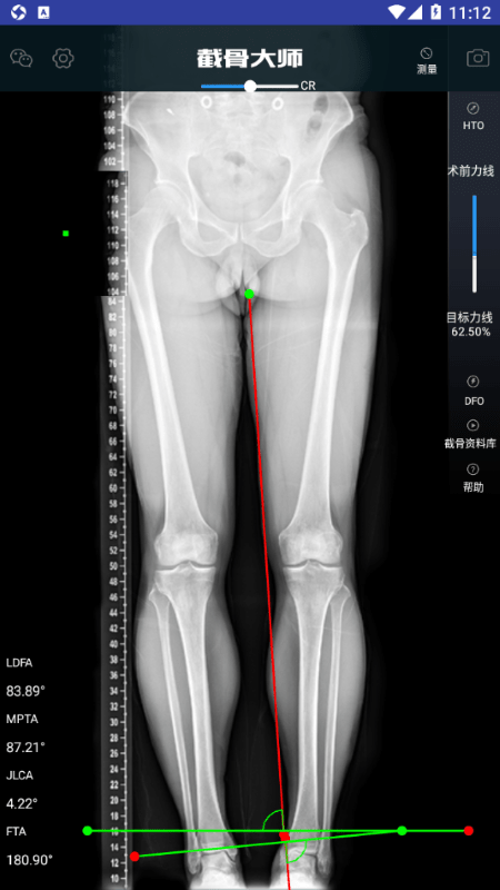 截骨大师