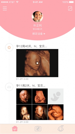 胎儿相机手机版