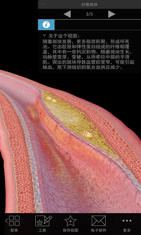 3D生理和病理学医学通
