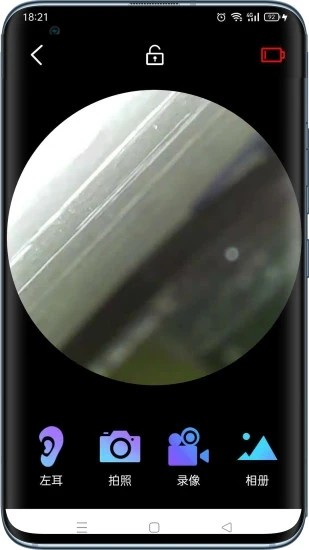 可视采耳设备多少钱一套