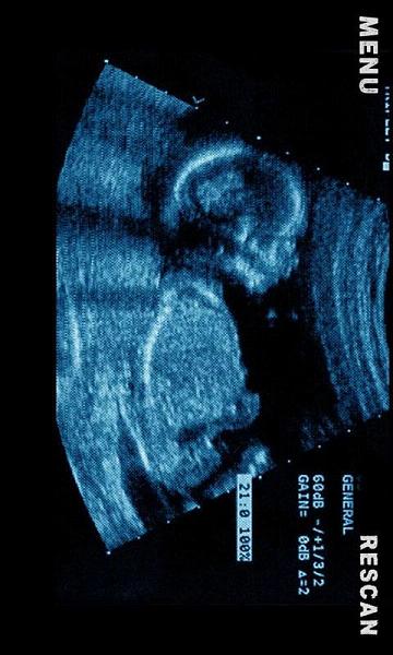 B超手机扫描恶搞