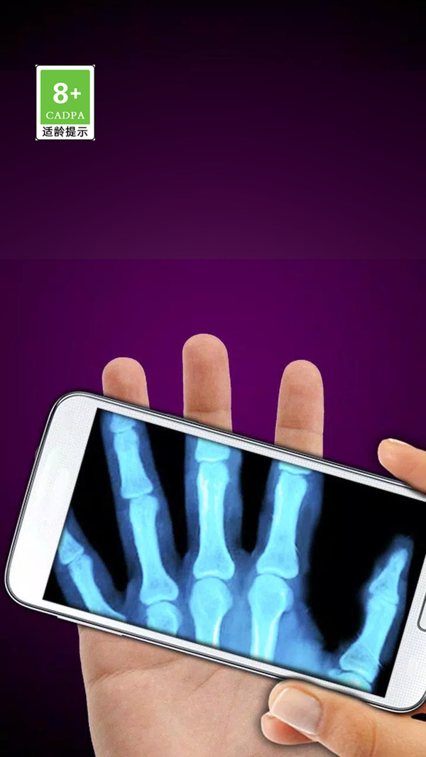 模拟X射线 模拟X射线